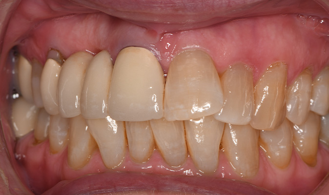 before dental work at Cereus Dental Care