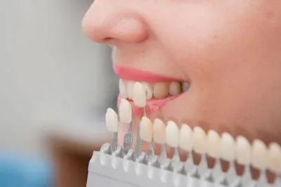 patient choosing a color for her dental veneers