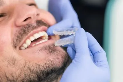 man getting fitted for Invisalign clear aligners