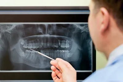 dentist reviewing a patient's dental x-rays