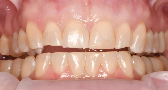Before image
